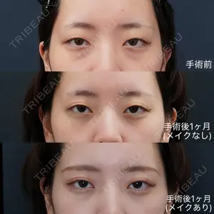 症例