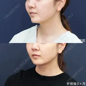 症例