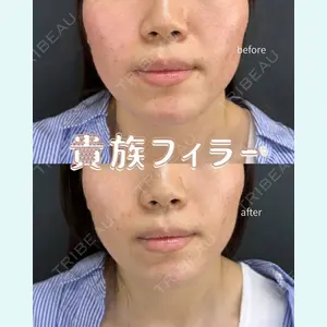 症例