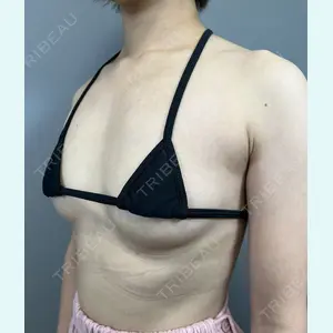 症例