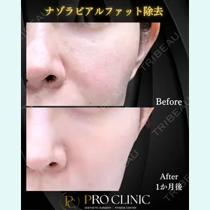 柚﨑 一輝医師の症例