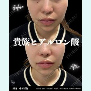 症例