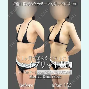 症例