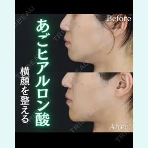 症例