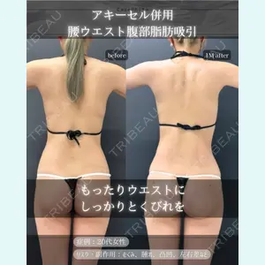 症例