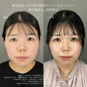 症例
