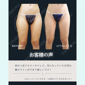症例