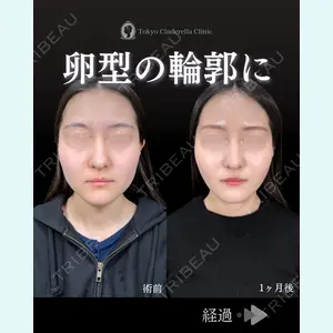 症例