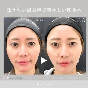 症例