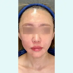 NEXUS CLINIC 酒井　知子医師の症例