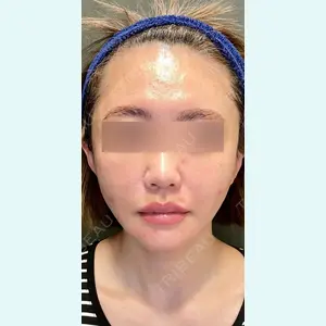 NEXUS CLINIC 酒井　知子医師の症例