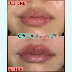 症例