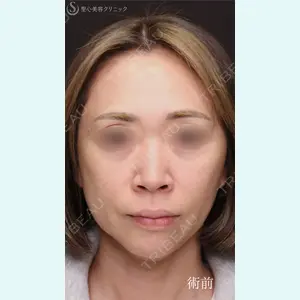 症例
