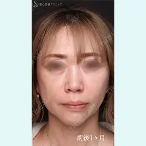 症例