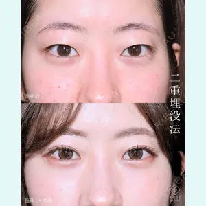 症例