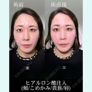 症例