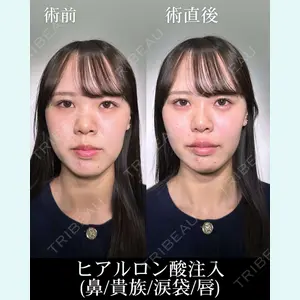 症例