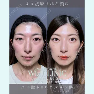 症例