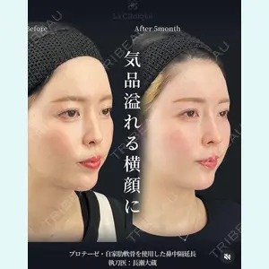 症例