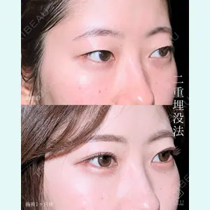 症例
