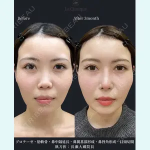 症例