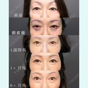 症例