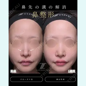 症例