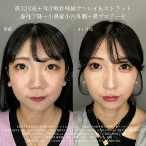 症例
