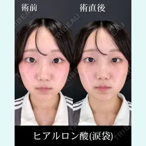 症例