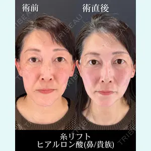 症例