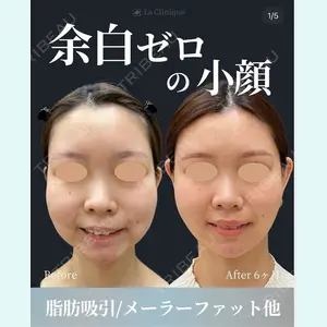 症例