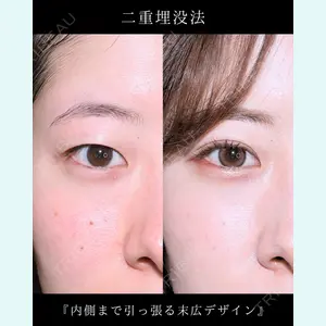 症例