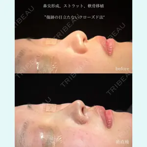 症例