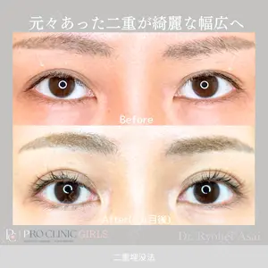 症例