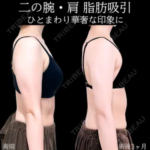 症例