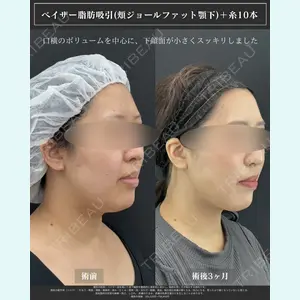 症例