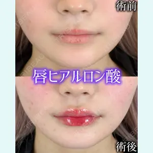 症例