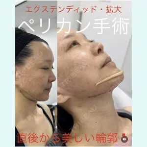 症例