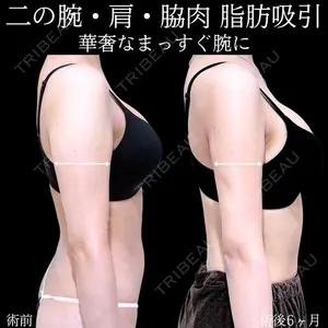 症例