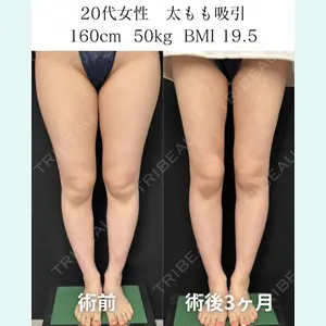 症例
