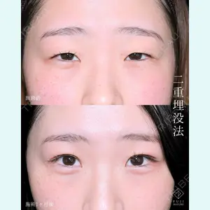 症例