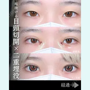 症例