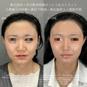 症例