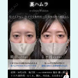症例