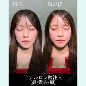 症例