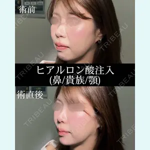 症例