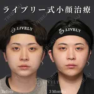 症例
