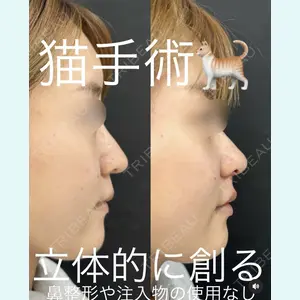 症例
