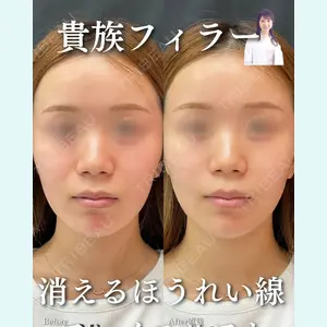 症例