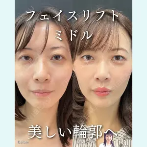 症例